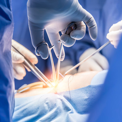 Клинические примеры применения ГЕМОБЛОК в кардиохирургии 